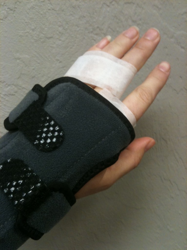 Broken knuckle brace